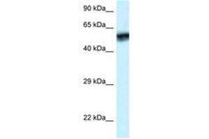 Image no. 1 for anti-Calcium/calmodulin-Dependent Protein Kinase IV (CAMK4) (AA 53-102) antibody (ABIN6747334) (CAMK4 antibody  (AA 53-102))