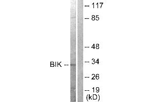 Western blot analysis of extracts from A549 cells, treated with DMSO (0.