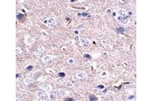 Immunohistochemistry (IHC) image for anti-Programmed Cell Death 1 (PDCD1) antibody (ABIN1031790) (PD-1 antibody)