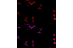 Immunofluorescence analysis of NIH/3T3 cells using CD40L antibody (ABIN6133614, ABIN6138190, ABIN6138191 and ABIN6216826) at dilution of 1:100. (CD40 Ligand antibody  (AA 79-129))