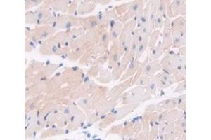 Figure. (Coagulation Factor VIII-Associated 1 (F8A1) (AA 171-375) antibody)