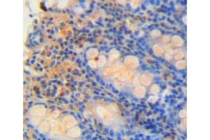 IHC-P analysis of rectum tissue, with DAB staining. (REG4 antibody  (AA 45-151))