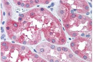 Human Kidney: Formalin-Fixed, Paraffin-Embedded (FFPE) (MAPT antibody  (Ser404))