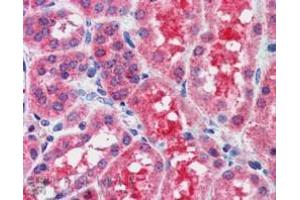 Image no. 3 for anti-Suppressor of Cytokine Signaling 1 (SOCS1) (C-Term) antibody (ABIN374072) (SOCS1 antibody  (C-Term))