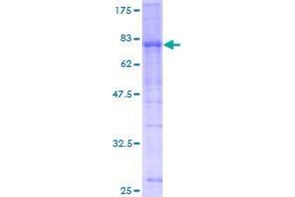 USP25 Protein (AA 1-450) (GST tag)