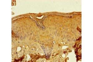 Immunohistochemistry of paraffin-embedded human skin tissue using ABIN7157925 at dilution of 1:100