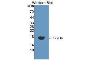 Western blot analysis of the recombinant protein. (VEGFC antibody  (AA 212-327))