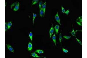 Immunofluorescent analysis of Hela cells using ABIN7150756 at dilution of 1:100 and Alexa Fluor 488-congugated AffiniPure Goat Anti-Rabbit IgG(H+L) (DUSP19 antibody  (AA 1-217))