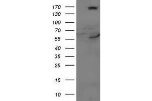 HEK293T cells were transfected with the pCMV6-ENTRY control (Left lane) or pCMV6-ENTRY CYP2J2 (Right lane) cDNA for 48 hrs and lysed. (CYP2J2 antibody)