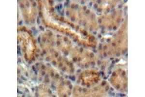 Used in DAB staining on fromalin fixed paraffin-embedded Kidney tissue (EPO antibody  (AA 28-192))