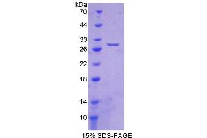 Image no. 1 for Crystallin, beta A1 (CRYBA1) (AA 1-215) protein (His tag) (ABIN4990395)