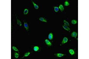 Immunofluorescent analysis of Hela cells using ABIN7157846 at dilution of 1:100 and Alexa Fluor 488-congugated AffiniPure Goat Anti-Rabbit IgG(H+L) (EPM2A antibody  (Isoform 9))