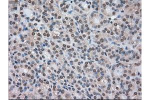 Image no. 6 for anti-Cancer/testis Antigen 1B (CTAG1B) antibody (ABIN1499905) (CTAG1B antibody)