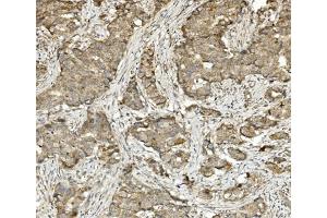 IHC analysis of Methylmalonyl Coenzyme A using anti-Methylmalonyl Coenzyme A antibody (ABIN7603112). (MUT antibody  (N-Term))