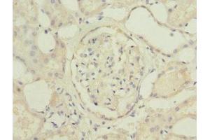 Immunohistochemistry of paraffin-embedded human kidney tissue using ABIN7174771 at dilution of 1:100 (C19orf48 antibody  (AA 1-117))