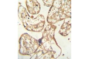 Formalin fixed and paraffin embedded human placenta tissue reacted with PSG9 Antibody (Center) followed by peroxidase conjugation of the secondary antibody and DAB staining.