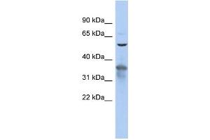 WB Suggested Anti-RAB3IP Antibody Titration: 0. (RAB3IP antibody  (N-Term))