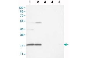 Western blot analysis of Lane 1: RT-4, Lane 2: U-251 MG, Lane 3: Human Plasma, Lane 4: Liver, Lane 5: Tonsil with RPS25 polyclonal antibody  at 1:100 - 1:250 dilution.