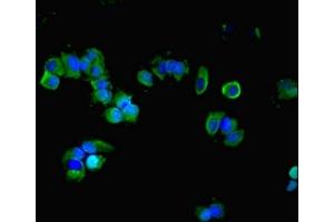 Immunofluorescent analysis of MCF-7 cells using ABIN7154707 at dilution of 1:100 and Alexa Fluor 488-congugated AffiniPure Goat Anti-Rabbit IgG(H+L) (GNAS antibody  (AA 1-394))