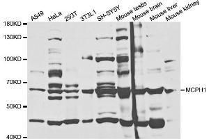Western blot analysis of extracts of various cell lines, using MCPH1 antibody (ABIN5973185) at 1/1000 dilution.