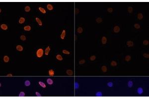 Immunofluorescence (IF) image for anti-Histone H2B (acLys12) antibody (ABIN7258518)