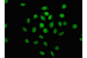 Immunofluorescence staining of A549 cells with ABIN7150334 at 1:100, counter-stained with DAPI. (MCM4 antibody  (AA 2-141))
