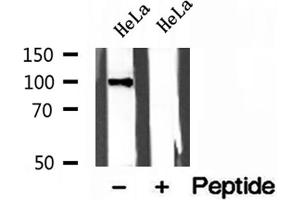 Western blot analysis of extracts of HeLa cells, using LONP1 antibody. (LONP1 antibody  (C-Term))
