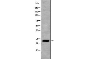 Western blot analysis of RALB using K562 whole cell lysates (RALB antibody  (C-Term))