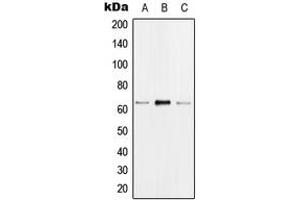 Western blot analysis of hnRNP K (pS284) expression in MCF7 EGF-treated (A), Raw264. (HNRNPK antibody  (pSer284))