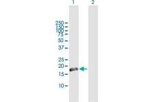 Western Blot analysis of CETN1 expression in transfected 293T cell line by CETN1 MaxPab polyclonal antibody. (Centrin 1 antibody  (AA 1-172))