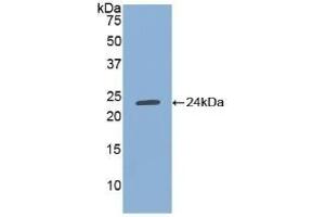 Detection of Recombinant TIMP1, Human using Polyclonal Antibody to Tissue Inhibitors Of Metalloproteinase 1 (TIMP1) (TIMP1 antibody  (AA 25-207))