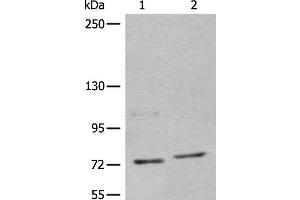 Western blot analysis of 562 and Jurkat cell lysates using NCAPH Polyclonal Antibody at dilution of 1:450 (NCAPH antibody)