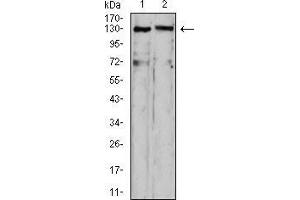 Western blot analysis using OTUD4 mouse mAb against HepG2 (1) and C6 (2) cell lysate. (OTUD4 antibody  (AA 815-1049))