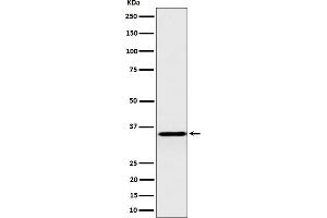 Western blot analysis of Pyrophosphatase 1 expression in HepG2 cell lysate.