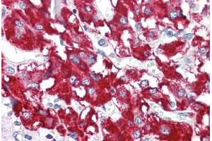 Human Adrenal (formalin-fixed, paraffin-embedded) stained with BAG1 antibody ABIN214400 at 2. (BAG1 antibody  (N-Term))