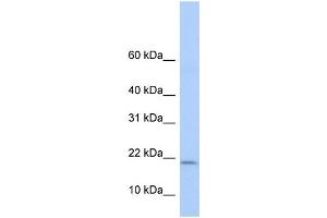 WB Suggested Anti-POLR1D Antibody Titration:  0. (POLR1D antibody  (Middle Region))