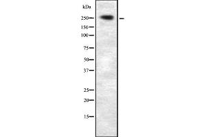 Western blot analysis of PLCE1 expression in HEK293 cells ,The lane on the left is treated with the antigen-specific peptide. (PLCE1 antibody)