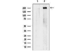 anti-Cadherin EGF LAG Seven Pass G-Type Receptor 2 (CELSR2) (C-Term) antibody