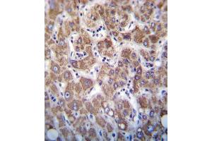 OC2 Antibody (Center) 7796c immunohistochemistry analysis in formalin fixed and paraffin embedded human liver tissue followed by peroxidase conjugation of the secondary antibody and DAB staining. (Apolipoprotein C-II antibody  (AA 45-73))