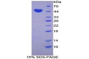 SDS-PAGE analysis of Cow Chromogranin B Protein. (CHGB Protein)