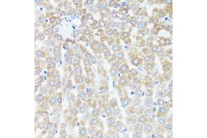 Immunohistochemistry (Paraffin-embedded Sections) (IHC (p)) image for anti-Cytochrome C, Somatic (CYCS) (AA 1-105) antibody (ABIN6139304)
