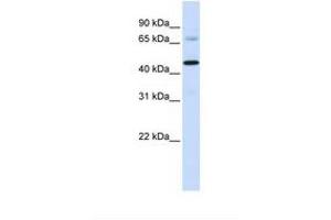 Image no. 1 for anti-Sideroflexin 4 (SFXN4) (C-Term) antibody (ABIN6739423) (Sideroflexin 4 antibody  (C-Term))