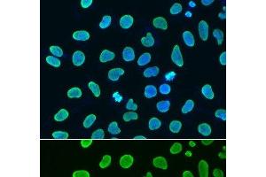 Immunofluorescence analysis of HeLa cells using Acetyl-Histone H4-K8 Polyclonal Antibody (Histone H4 antibody  (acLys8))