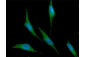ICC/IF analysis of RNH1 in PC3 cells line, stained with DAPI (Blue) for nucleus staining and monoclonal anti-human RNH1 antibody (1:100) with goat anti-mouse IgG-Alexa fluor 488 conjugate (Green). (RNH1 antibody  (AA 7-461))