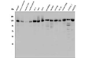 Western blot analysis of USP25 using anti-USP25 antibody (ABIN7598940).