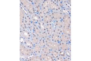 Immunohistochemistry of paraffin-embedded Mouse kidney using MTMR8 Rabbit pAb (ABIN7268766) at dilution of 1:100 (40x lens). (MTMR8 antibody  (AA 430-560))