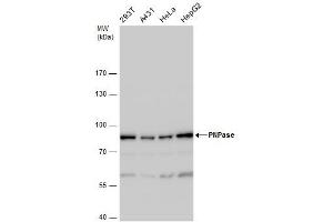 WB Image PNPase antibody detects PNPase protein by western blot analysis. (PNPT1 antibody)