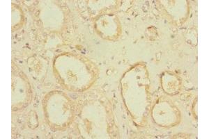 Immunohistochemistry of paraffin-embedded human kidney tissue using ABIN7163729 at dilution of 1:100 (POGK antibody  (AA 101-400))