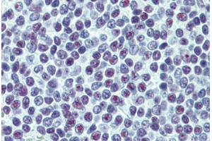 Human Spleen: Formalin-Fixed, Paraffin-Embedded (FFPE)