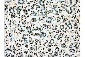 Immunohistochemical staining of paraffin-embedded breast tissue using anti-TYRO3 mouse monoclonal antibody. (TYRO3 antibody)